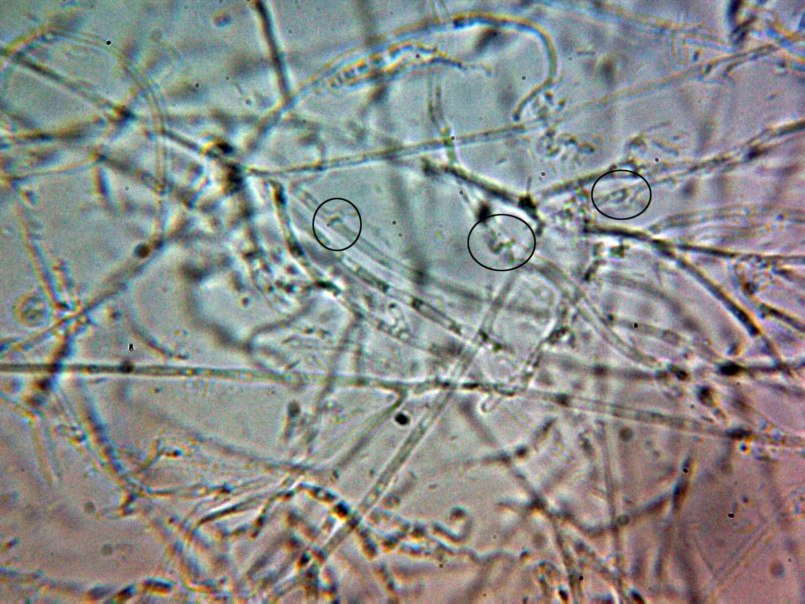 Microscopía de Tremella globispora - 10 - Hifas fibuladas